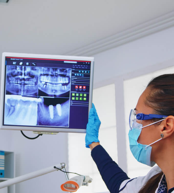 Dental X Rays Image Dental X Rays Image