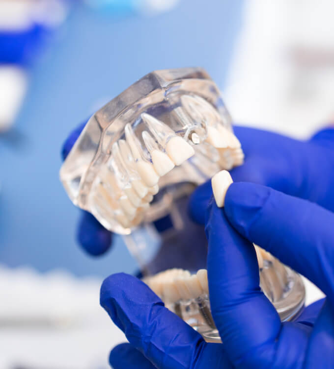Dentures & Partial Dentures Image Dentures & Partial Dentures Image