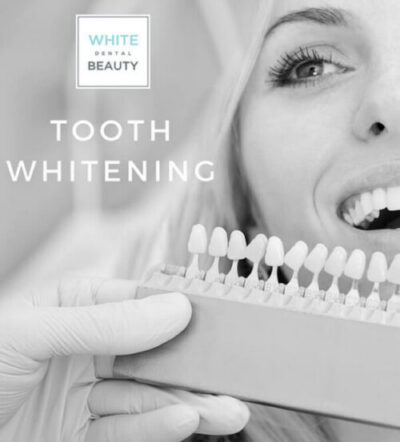 Teeth Whitening Header Image Teeth Whitening Header Image