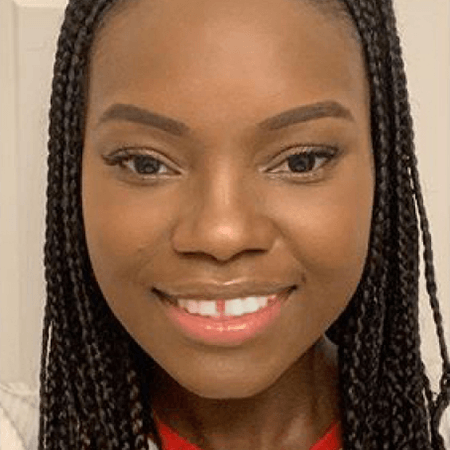 Pura Vida Dental Invisalign Smileview A Before
