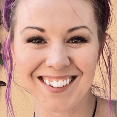 Pura Vida Dental Invisalign Smileview B Before